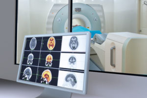 Medical scan monitor